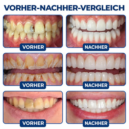 Dr.Fachmer® DentRestore Zahnreparatur- und Füllsystem 🌻
